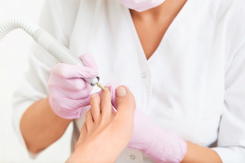 Pedicure